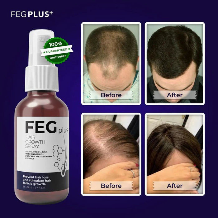 FEG Hair Growth Spray – Unlock the Secret to Luscious Locks!